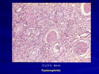 pathology practical original slide NO4
