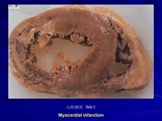 pathology practical original slide NO4