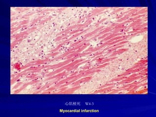 pathology practical original slide NO4