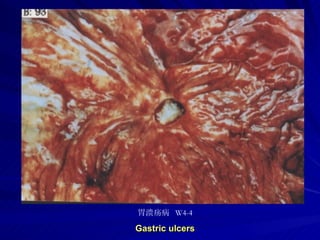 pathology practical original slide NO4