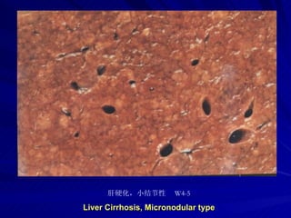 pathology practical original slide NO4