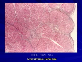 pathology practical original slide NO4