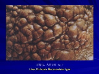 pathology practical original slide NO4