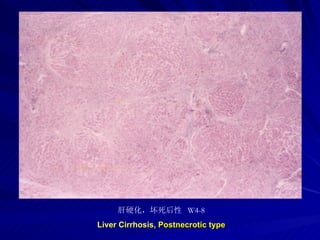 pathology practical original slide NO4