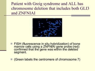 Greig Cephalopolysyndactyly Syndrome | PPT