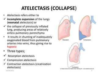 ATELECTASIS (COLLAPSE)
• Atelectasis refers either to
 incomplete expansion of the lungs
(neonatal atelectasis) or
 the collapse of previously inflated
lung, producing areas of relatively
airless pulmonary parenchyma
• It results in shunting of inadequately
oxygenated blood from pulmonary
arteries into veins, thus giving rise to
hypoxia
• Three types;
 Resorption atelectasis
 Compression atelectasis
 Contraction atelectasis (cicatrization
atelectasis)
10/24/2023 3
 