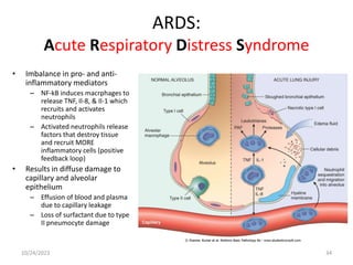 ARDS:
Acute Respiratory Distress Syndrome
• Imbalance in pro- and anti-
inflammatory mediators
– NF-kB induces macrphages to
release TNF, Il-8, & Il-1 which
recruits and activates
neutrophils
– Activated neutrophils release
factors that destroy tissue
and recruit MORE
inflammatory cells (positive
feedback loop)
• Results in diffuse damage to
capillary and alveolar
epithelium
– Effusion of blood and plasma
due to capillary leakage
– Loss of surfactant due to type
II pneumocyte damage
10/24/2023 34
 