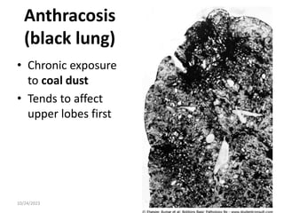 Anthracosis
(black lung)
• Chronic exposure
to coal dust
• Tends to affect
upper lobes first
10/24/2023 39
 