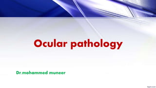Ocular pathology
Dr.mohammed muneer
 