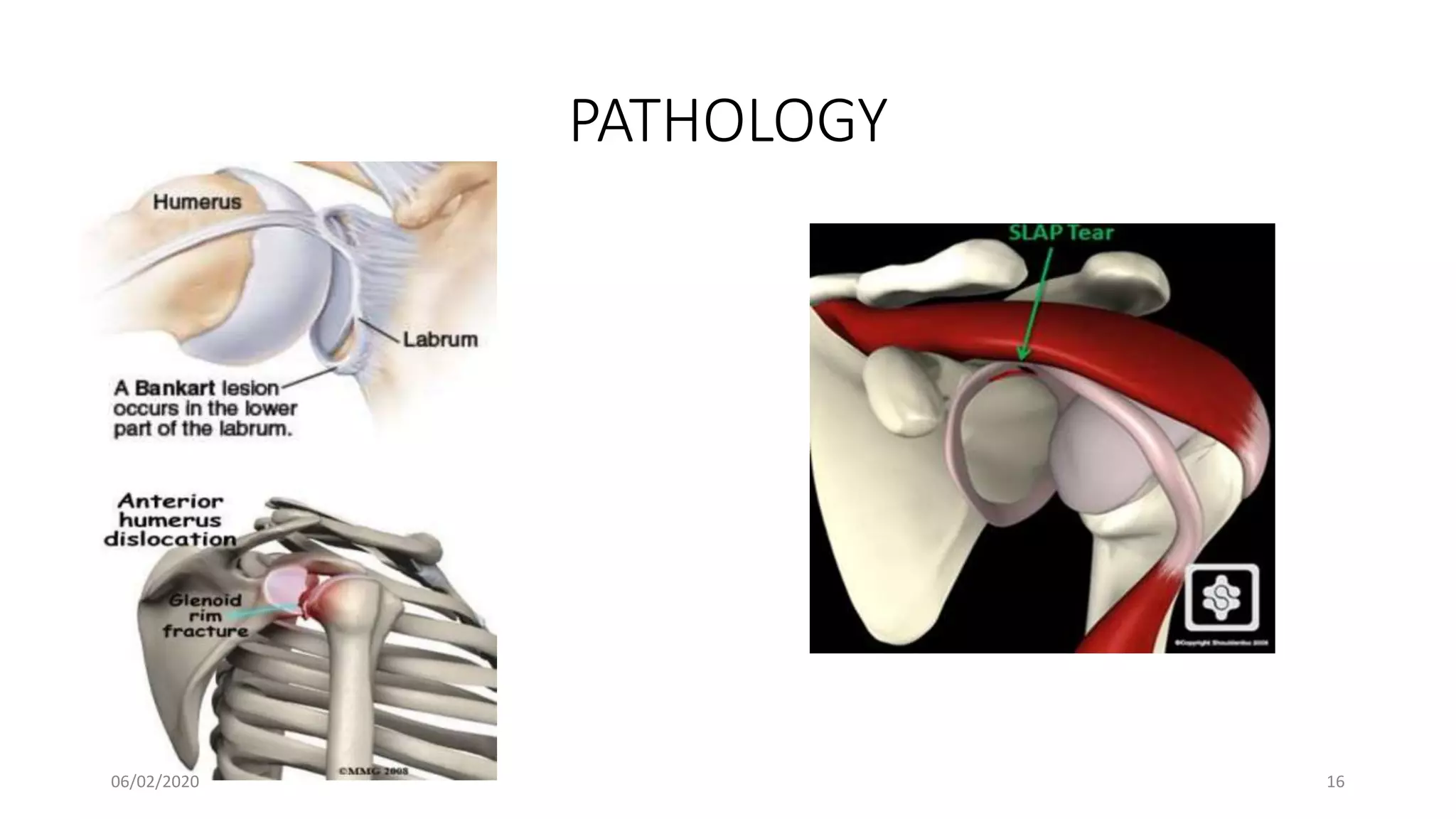 PATHOLOGY
06/02/2020 16
 