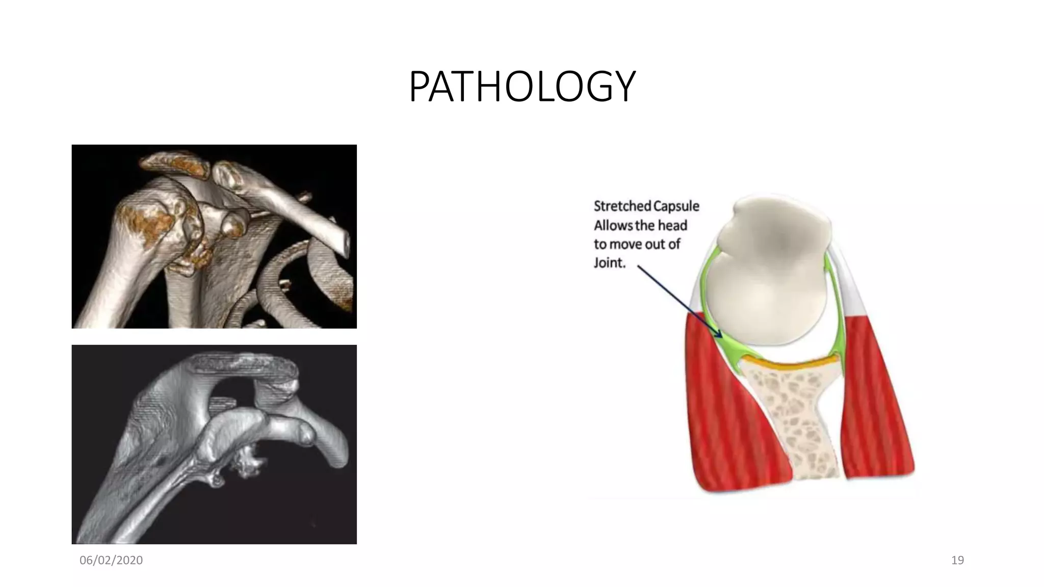 PATHOLOGY
06/02/2020 19
 