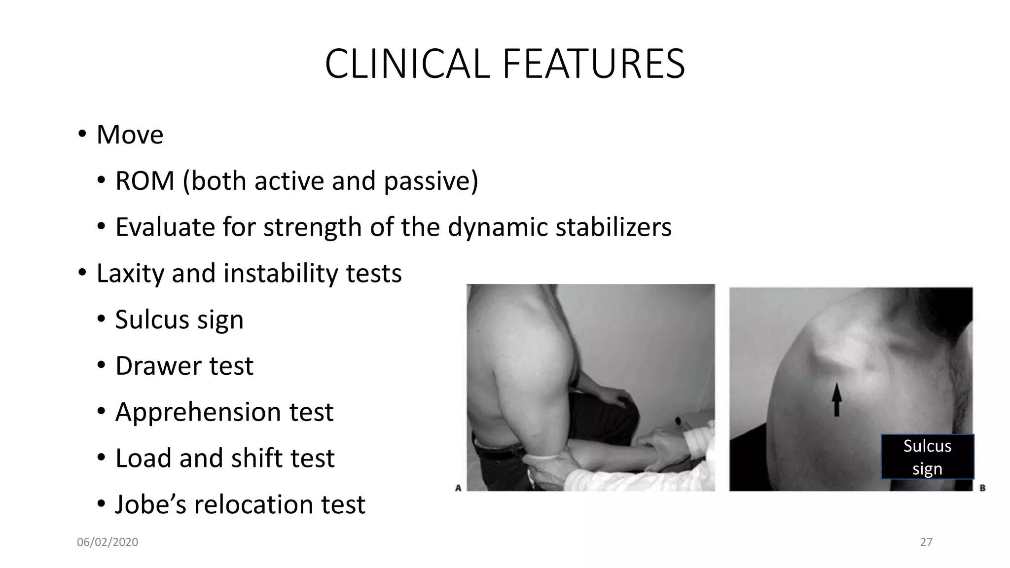 CLINICAL FEATURES
• Move
• ROM (both active and passive)
• Evaluate for strength of the dynamic stabilizers
• Laxity and instability tests
• Sulcus sign
• Drawer test
• Apprehension test
• Load and shift test
• Jobe’s relocation test
Sulcus
sign
06/02/2020 27
 