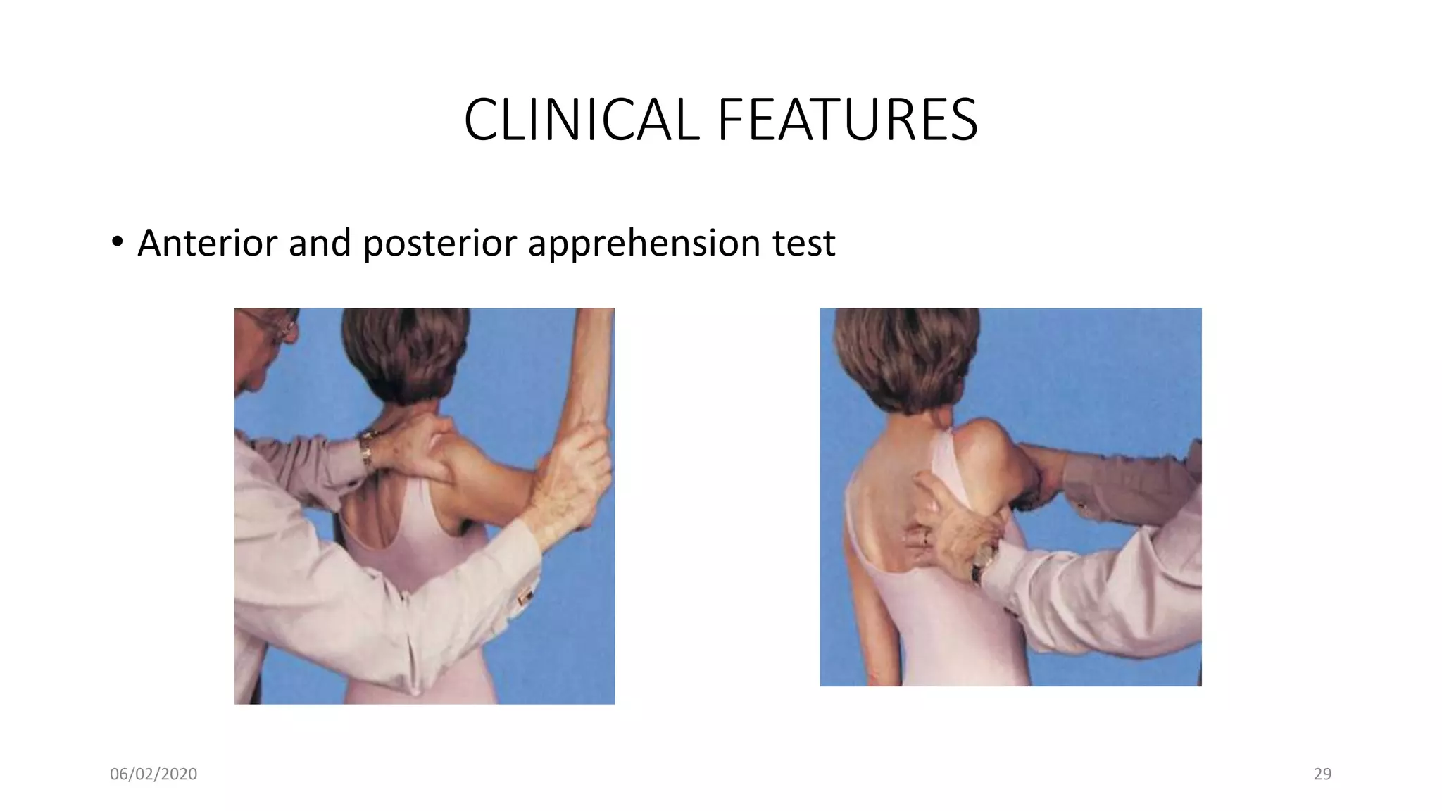 CLINICAL FEATURES
• Anterior and posterior apprehension test
06/02/2020 29
 