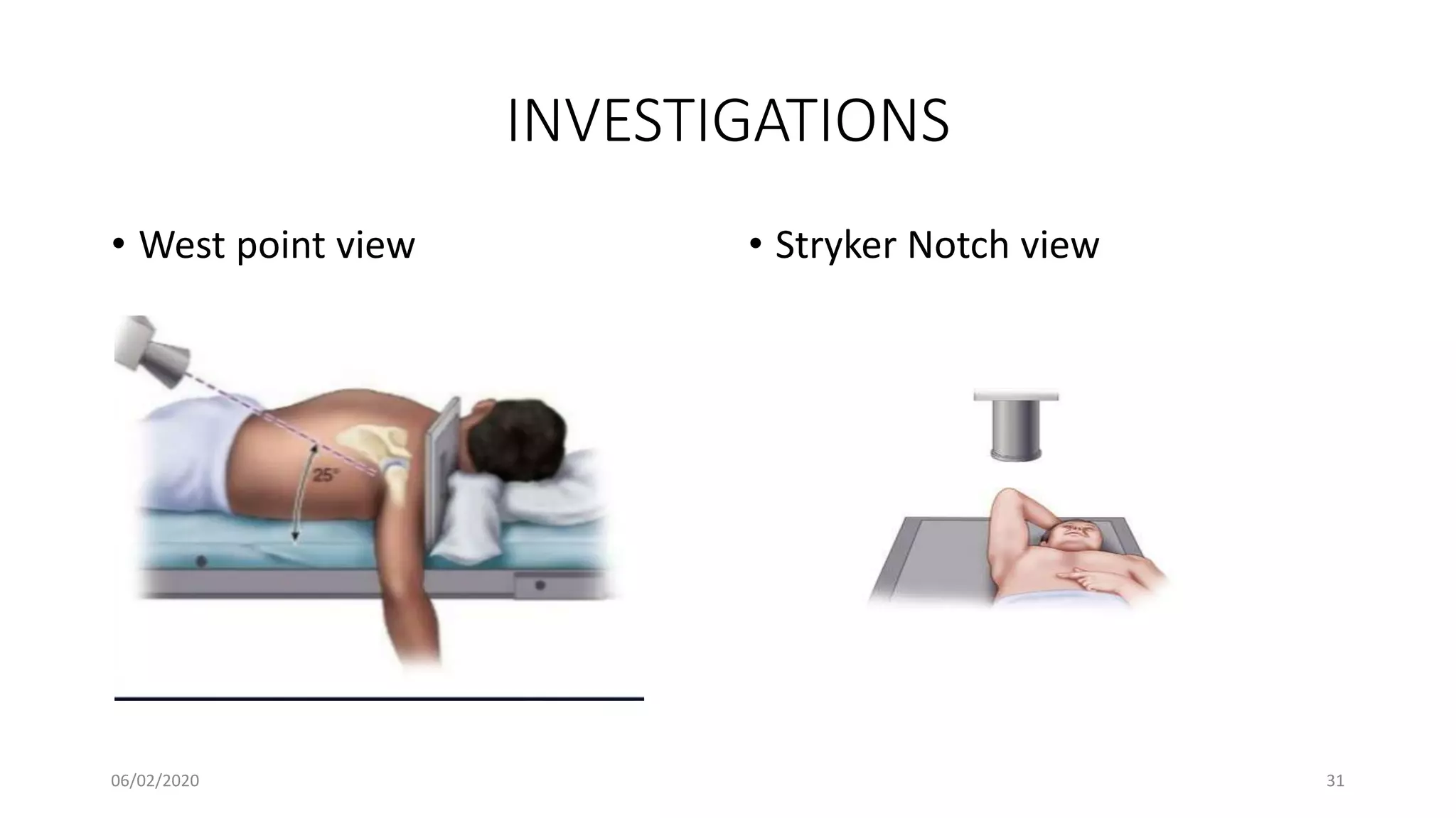 INVESTIGATIONS
• West point view • Stryker Notch view
06/02/2020 31
 