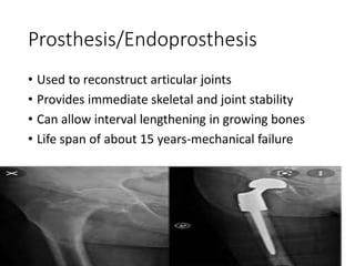 Prosthesis/Endoprosthesis
• Used to reconstruct articular joints
• Provides immediate skeletal and joint stability
• Can allow interval lengthening in growing bones
• Life span of about 15 years-mechanical failure
 