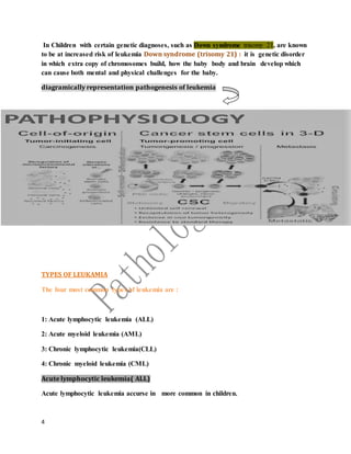Leukemia slide share