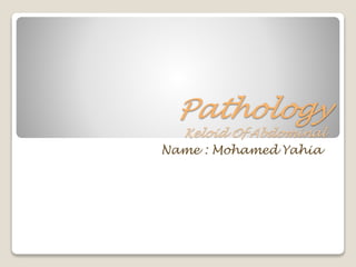 Pathology
Keloid Of Abdominal
Name : Mohamed Yahia
 