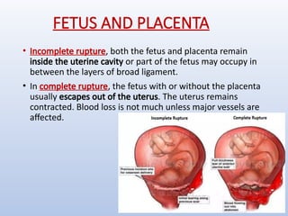 Birth canal injury in obstetrics and gynaecology.pptx