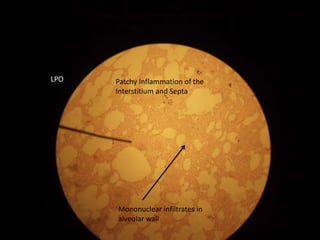 Pathology Final Practical | PPTX