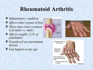 Rheumatoid   Arthritis Inflammatory condition Affects other organs of body Three times more common in females vs. males  Affects roughly 2.5% of population Considered an autoimmune disease Can happen at any age 