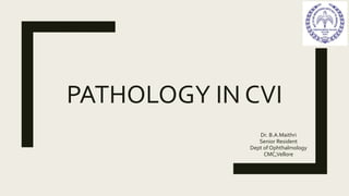 PATHOLOGY IN CVI
Dr. B.A.Maithri
Senior Resident
Dept of Ophthalmology
CMC,Vellore
 