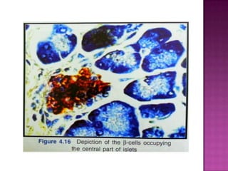 Picture of Islet cell Pathology | PPTX