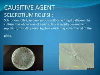 CAUSITIVE AGENT
SCLEROTIUM ROLFSII:
Sclerotium rolfsii, an omnivorous, soilborne fungal pathogen. In
culture, the whole area of a petri plate is rapidly covered with
mycelium, including aerial hyphae which may cover the lid of the
plate.
 