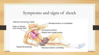 Comprehensive Overview of Vascular Disorders, Shock, and Thromboembolic ...
