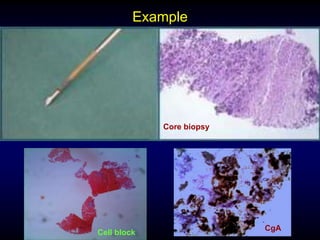 Pathology NET.ppt