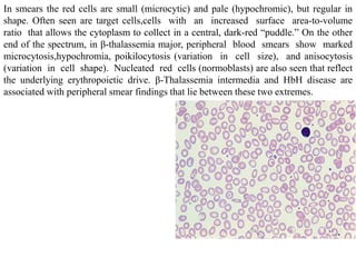 Pathology of blood | PPTX