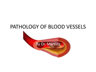 PATHOLOGY OF BLOOD VESSELS
By Dr. Martins
 
