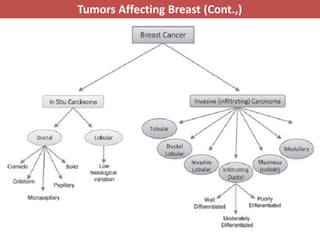 Preast Cancer Pathology of breast cancer | PPTX