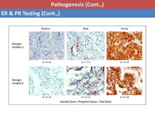 Pathology of breast cancer | PPTX