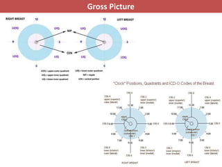 Pathology of breast cancer | PPTX