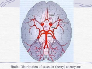 Brain: Distribution of saccular (berry) aneurysms 