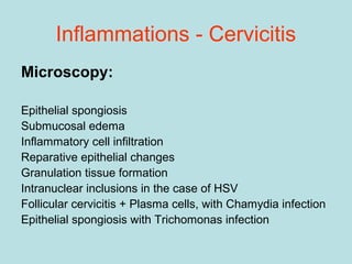 Microscopy:
Epithelial spongiosis
Submucosal edema
Inflammatory cell infiltration
Reparative epithelial changes
Granulation tissue formation
Intranuclear inclusions in the case of HSV
Follicular cervicitis + Plasma cells, with Chamydia infection
Epithelial spongiosis with Trichomonas infection
Inflammations - Cervicitis
 