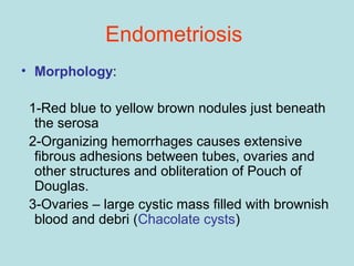 • Morphology:
1-Red blue to yellow brown nodules just beneath
the serosa
2-Organizing hemorrhages causes extensive
fibrous adhesions between tubes, ovaries and
other structures and obliteration of Pouch of
Douglas.
3-Ovaries – large cystic mass filled with brownish
blood and debri (Chacolate cysts)
Endometriosis
 