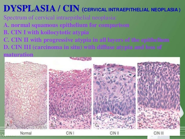 Pathology of cervix &uterus