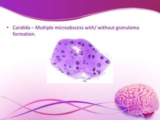 Pathology of cns | PPTX