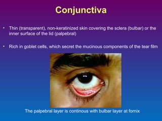 Conjunctiva
•

Thin (transparent), non-keratinized skin covering the sclera (bulbar) or the
inner surface of the lid (palpebral)

•

Rich in goblet cells, which secret the mucinous components of the tear film

The palpebral layer is continous with bulbar layer at fornix

 