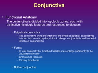 Conjunctiva
• Functional Anatomy
The conjunctiva is divided into topologic zones, each with
distinctive histologic features and responses to disease:
• Palpebral conjunctiva
– The conjunctiva lining the interior of the eyelid (palpebral conjunctiva)
is trown into minute papillary folds in allergic conjunctivitis and bacterial
infectious conjunctivitis

• Fornix
– In viral conjunctivitis, lymphoid follicles may enlarge sufficiently to be
visualized clinically
– Granulomas (sarcoid)
– Primary lymphoma

• Bulbar conjunctiva

 