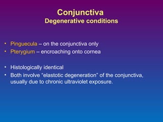 Conjunctiva
Degenerative conditions

• Pinguecula – on the conjunctiva only
• Pterygium – encroaching onto cornea
• Histologically identical
• Both involve “elastotic degeneration” of the conjunctiva,
usually due to chronic ultraviolet exposure.

 