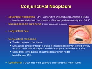 Conjunctival Neoplasm
– Squamous neoplasms (CIN – Conjunctival intraepithelial neoplasia & SCC)
• May be associated with the presence of human papillomavirus types 16 & 18

– Mucoepidermoid carcinoma (more aggressive course)
– Conjunctival nevi
– Conjunctival melanoma
• Tend to develop in the limbus
• Most cases develop through a phase of intraepithelial growth termed primary
acquired melanosis with atypia, which is analogous to melanoma in situ
• Spread first to the parotid or submandibular lymph nodes
• Mortality rate: 25%

– Lymphoma; Spread first to the parotid or submandibular lymph nodes

 