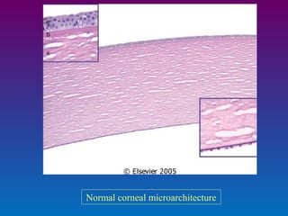 Normal corneal microarchitecture

 