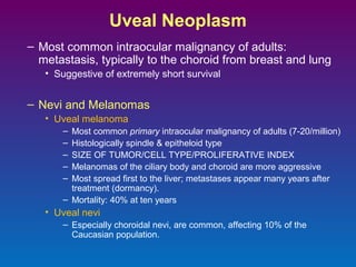 Uveal Neoplasm
– Most common intraocular malignancy of adults:
metastasis, typically to the choroid from breast and lung
• Suggestive of extremely short survival

– Nevi and Melanomas
• Uveal melanoma
–
–
–
–
–

Most common primary intraocular malignancy of adults (7-20/million)
Histologically spindle & epitheloid type
SIZE OF TUMOR/CELL TYPE/PROLIFERATIVE INDEX
Melanomas of the ciliary body and choroid are more aggressive
Most spread first to the liver; metastases appear many years after
treatment (dormancy).
– Mortality: 40% at ten years

• Uveal nevi
– Especially choroidal nevi, are common, affecting 10% of the
Caucasian population.

 