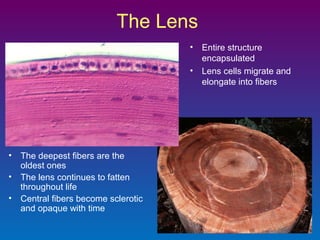 The Lens
•
•

•
•
•

The deepest fibers are the
oldest ones
The lens continues to fatten
throughout life
Central fibers become sclerotic
and opaque with time

Entire structure
encapsulated
Lens cells migrate and
elongate into fibers

 
