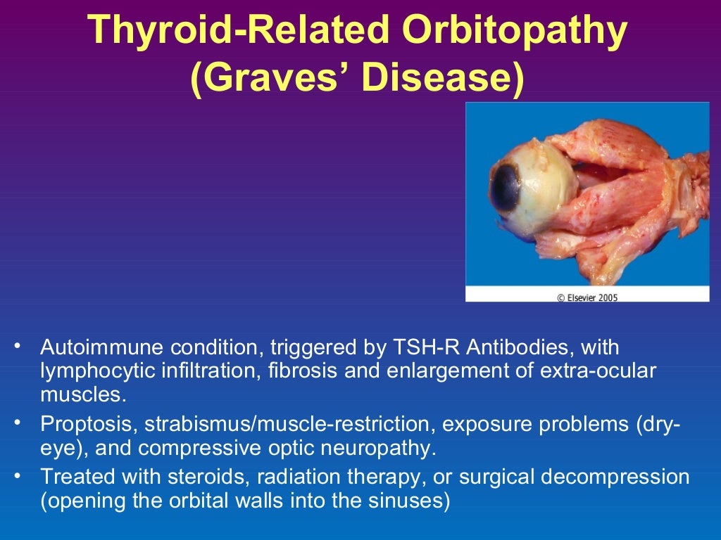 Pathology of eye i2013final
