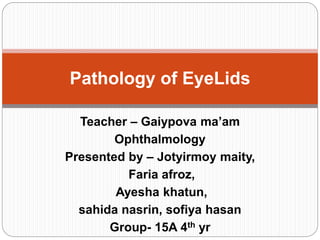 Teacher – Gaiypova ma’am
Ophthalmology
Presented by – Jotyirmoy maity,
Faria afroz,
Ayesha khatun,
sahida nasrin, sofiya hasan
Group- 15A 4th yr
Pathology of EyeLids
 