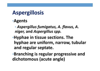 Aspergillosis
•Agents
• Aspergillus fumigatus, A. flavus, A.
niger, and Aspergillus spp.
•Hyphae in tissue sections. The
hyphae are uniform, narrow, tubular
and regular septate.
•Branching is regular progressive and
dichotomous (acute angle)
 
