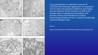 Pathology of mechanical asphyxia - a brief overview | PPTX